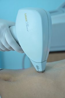 Center for laser cosmetology «Medline». sign up for laser treatments for the promotion.