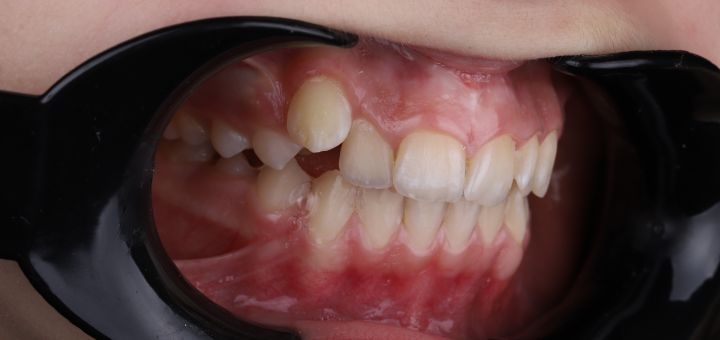 Dentist orthodontist in kiev, discounts on services