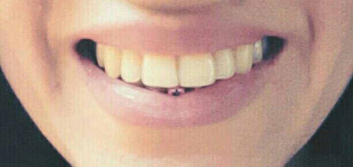 Discounts for dentistry in the clinic of aesthetic medicine «Ex Tempore»