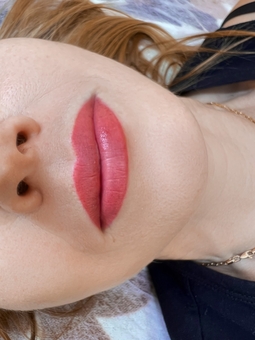 photo