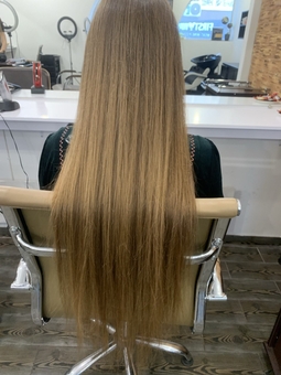 Hair restoration (before photo)