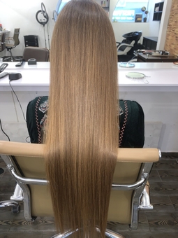 Hair restoration (after photo)