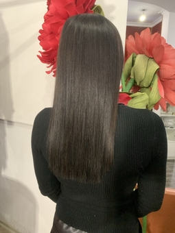 Hair restoration (after photo)
