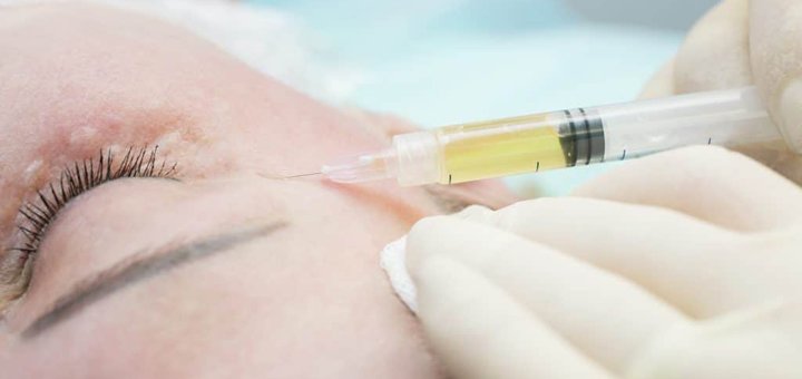 Редермализация Hyalual у косметолога Ольги Бугаевой в Киеве. Записывайтесь по акции.